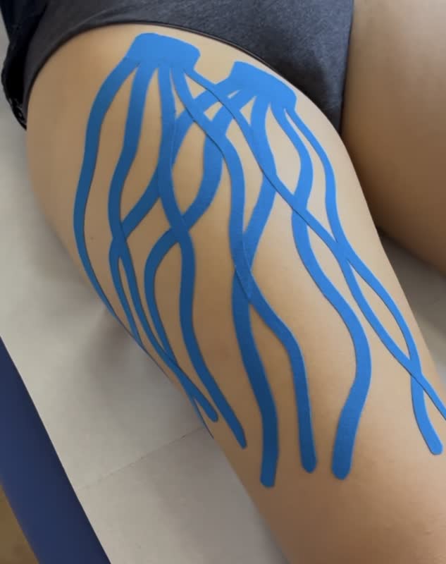Kinesiotaping